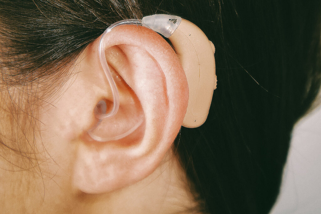 A white woman with brown hair wears an MDHearing hearing aid